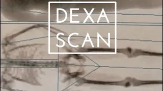 DEXA Scan, Cryotherapy, Resting Metabolic Rate all being put to the test!