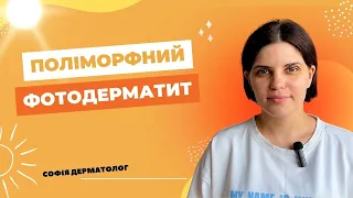 Алергія на сонце! Поліморфний фотодерматит. Що робити? Лікар-дерматолог. Одеса