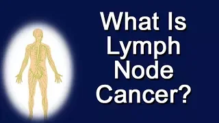 What Is Lymph Node Cancer?