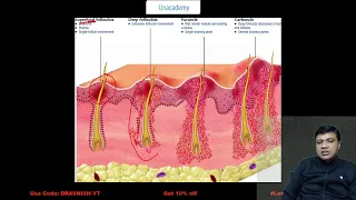 Dermatology Recall MCQs of FMGE December 2020 (Part 1  Dr. Avnish Goel