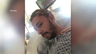 ‘An inch away from death:’ Florida man survives alligator bite to the head