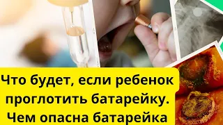 Что будет, если проглотить батарейку.Чем опасна батарейка.здоровьемедицинаболезньврач