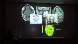 Case ORL Parapharyngeal tumors - Unknown