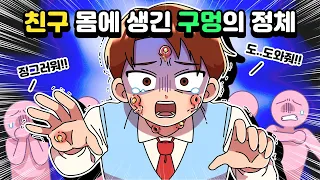 [체리툰] 친구 몸에 생긴 구멍의 정체?!