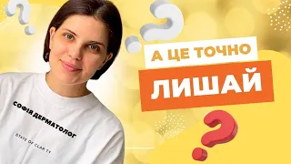 Лишай. Чи дійсно це він? Як відрізнити, як лікувати? Лікар-дерматолог. Одеса