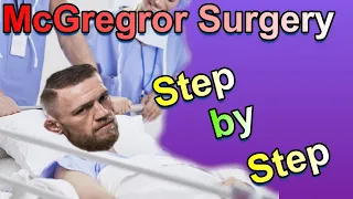 Doctor Explains Conor Mcgregor Surgery step by step.