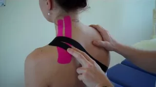 How to treat Neck pain - Levator Scapulae / Upper Trapezius Strain using Kinesiology Tape