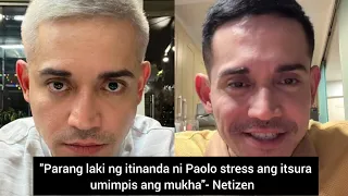 Paolo Contis pansin ang pag tanda ng itsura at biglaang pag payat