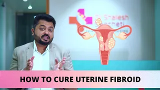 Uterine Fibroid Treatment by Homeopathy |  Best Homeopathic Treatment | DR SHAILESH SANCHETI