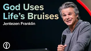 God Uses Life’s Bruises | Pastor Jentezen Franklin