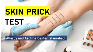 Skin prick test Painless Technology | A guide for Allergy and Asthma patient | dr shahid abbas