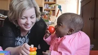 Baby Born With Four Legs And Two Spines Receives Life-Changing Operation