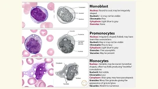 Medical Haematology - Monocyte maturation series (monoblast vs promonocyte vs monocyte)