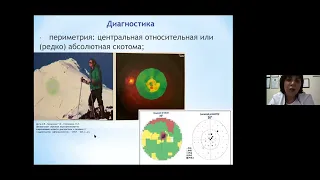 Центральная серозная хориоретинопатия диагностика и неинвазивная терапия  Отдаленные результаты