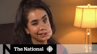 Canada comes to rescue of young Afghan woman