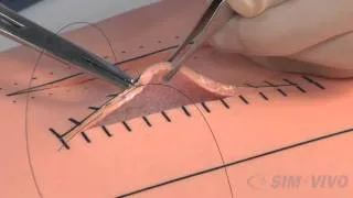 SIM SUTURE - 7. Running Subcuticular Suture