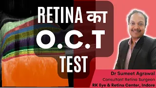 RETINA का OCT test. कुछ ही SECONDS में मिलती है RETINA की DETAILED REPORT