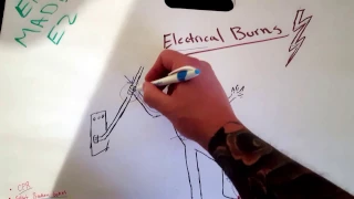 EMT Electrical Burns / EMT MADE EASY