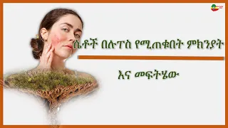 ሴቶች በሉፐስ የሚጠቁበት ምክንያት እና መፍትሄው  /Why women are affected by lupus and the solution