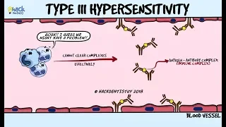 Type III Hypersensitivity - Immune complex disease