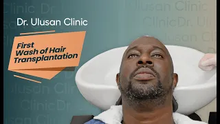 First Wash of Hair Transplantation 💥