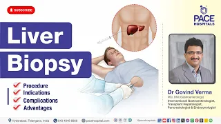 Liver Biopsy - Procedure, Indications, Complications & Advantages | Liver Biopsy Procedure