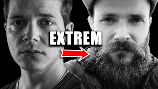 Meine BART Extreme vor, während und nach der Minoxidil Anwendung | Bartwuchs Info Check