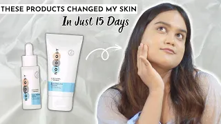 ANTI-ACNE Products That Truly Works! With Live Results