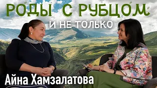 Роды с рубцом. И не только. Айна Хамзалатова