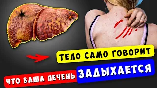 Тело кричит, что ПЕЧЕНЬ Задыхается! Первые признаки Заболевания печени. Вот что делать...