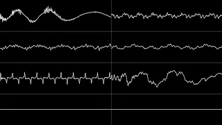 worldpeace - "Jazz Jackrabbit - Medivo" (SNES) [Oscilloscope View]