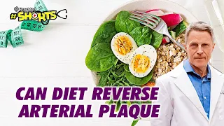 #SHORTS Can Diet Reverse Arterial Plaque?
