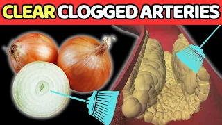 Top 10 SIMPLE DELICIOUS Foods To CLEAR Clogged Arteries.| Vitality Solutions