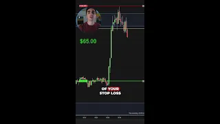 Miss Placed Stop losses Lose You Money