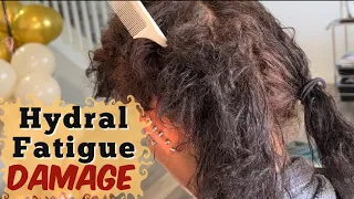 BEWARE‼️ of Hydral Fatigue | Too Much Water 💧 in Your Hair