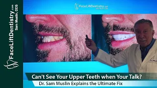 Can't See Your Upper Teeth when Your Talk?  The #1 Solution!