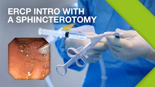 Olympus ERCP | ERCP Practical Guide | Part 1: Introduction with a Sphincterotomy | Gastroenterology