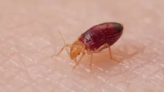 DANGEROUS bed bugs get stopped in their tracks deep look