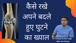 कैसे रखे अपने बदले हुए घुटने का ख्याल/Precaution after knee replacement/Dr Pradeep Kumar Singh /