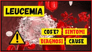 Leucemia: Cos'è? Come si sviluppa? Come viene diagnosticata? Quali sono i sintomi e le cause?