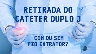 Retirada do Cateter Duplo J com ou sem fio extrator?