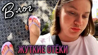 ОТЕКЛИ НОГИ И РУКИ! 🏨НЕМЕЮТ ПАЛЬЦЫ! ПРИЕМ У МАТРОНЫ! ПЕСЧАНЫЙ УРАГАН!🌪️ПОЖАР!