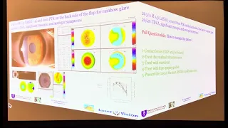 Custom Excimer Course Topo-Guided, RayTracing Cornea Diagnostics: IC-129 ASCRS 2024 Kanellopoulos MD