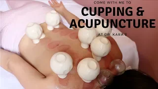 Get Acupuncture/ Cupping with Me! // HOLISTIC LIVING VLOG