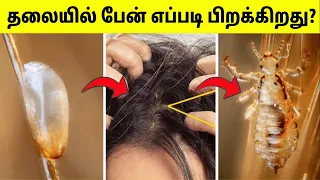 இப்படித்தான் உங்கள் தலையில் பேன் வரும் | Life Cycle Of Lice In Hair | Tamil Amazing Facts
