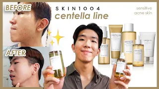 My Favourite Skincare Routine with Skin1004 Centella! | Glowy skin texture
