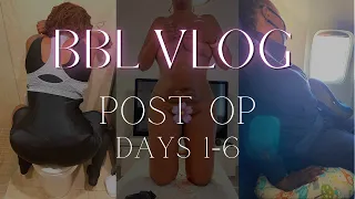 BBL VLOG 🍑| Putting on Faja | Using the Bathroom After BBL | Flying After BBL | Mia Aesthetics