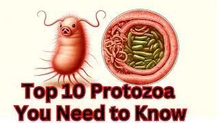 Top 10 Protozoa You Need to Know - Fascinating Microorganisms