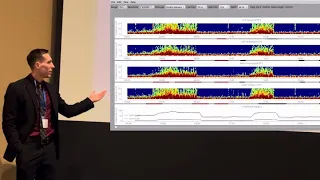 Introduction to QEEG