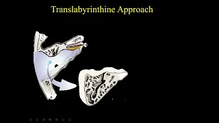 Suresh Mukherji  Imaging of Post op Temporal Bone